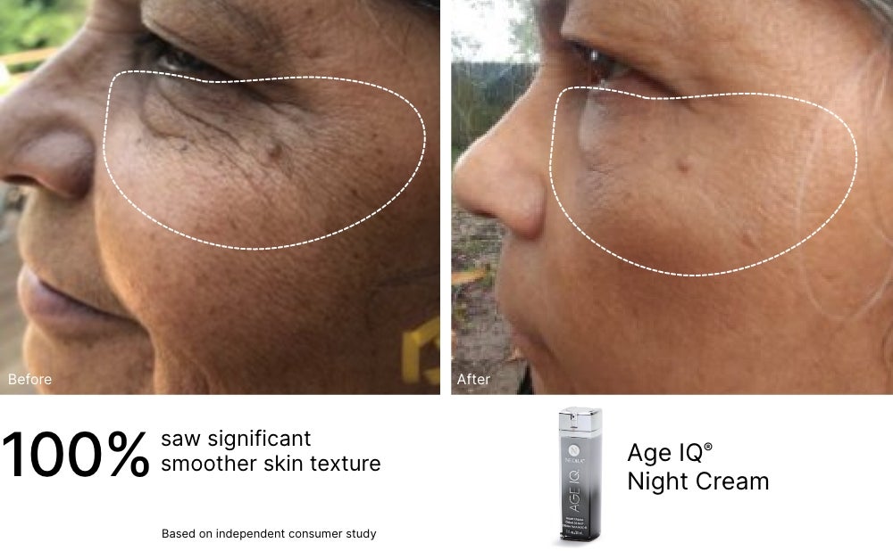 A before and after of a woman’s under-eye after using Age IQ Night Cream. 100% saw significant smoother skin texture.