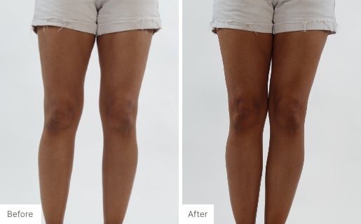 9 - Before and After Real Results of a woman's legs from using the 3-in-1 Self Tanning + Sculpting Foam.