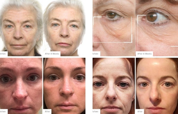A collage of before and after real results of customers that have used the New! Advanced Skincare Set.