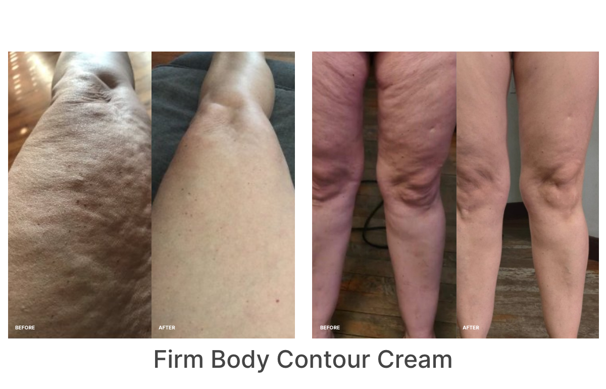 A collage of before and after Real Results of legs that have used the Firm Body Contour Cream.