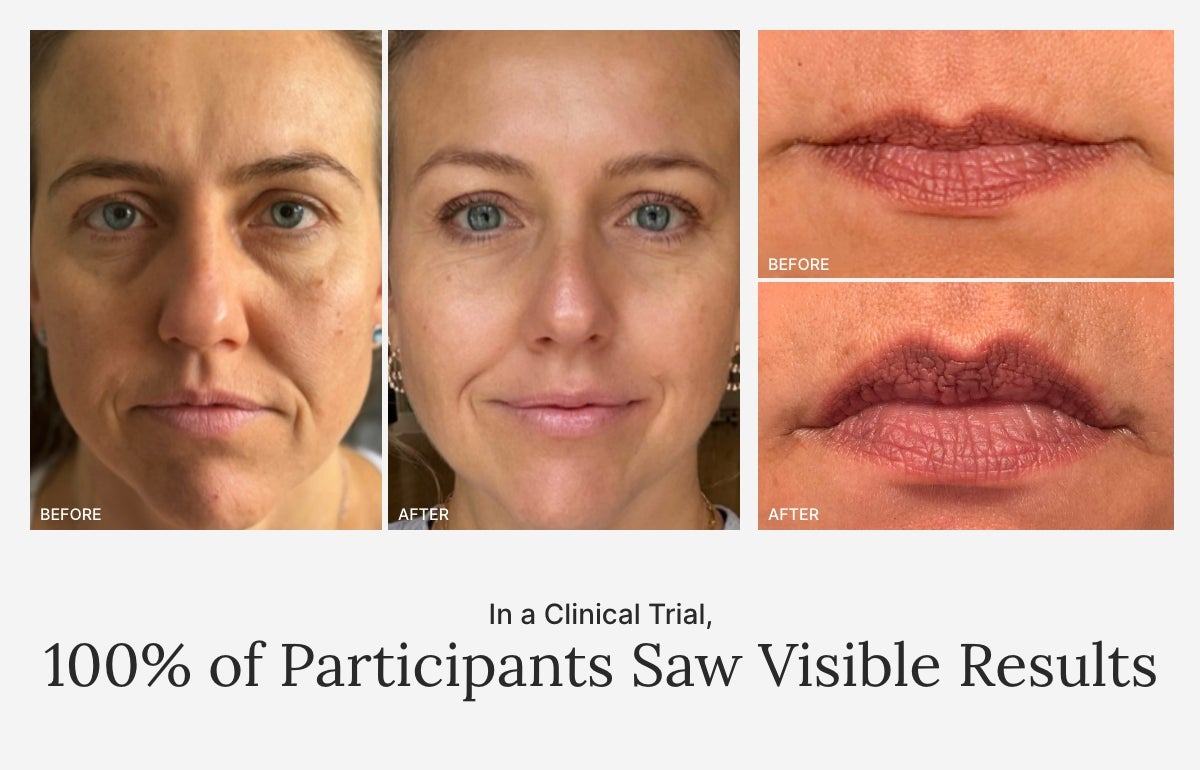 100% of clinical trial participants saw visible results. Featured is a collage of before and after results.