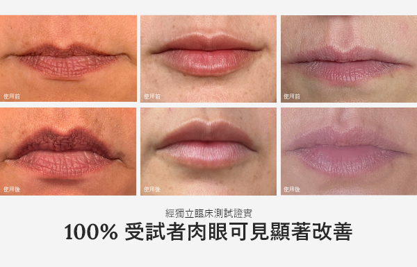 Before and After images of lips after using this product. In the independent trials, 100% of participants saw visible results.