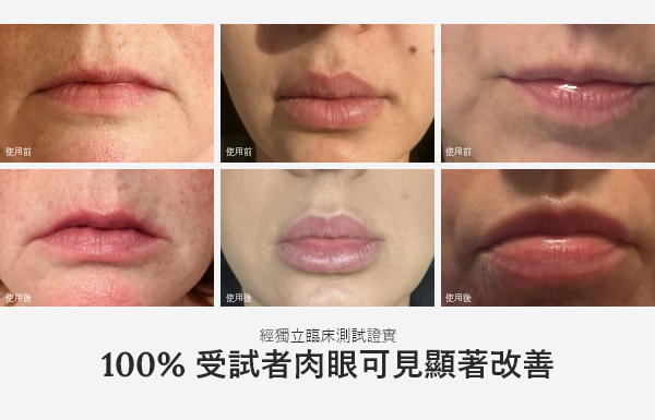 Before and After images of lips after using this product. In the independent trials, 100% of participants saw visible results.