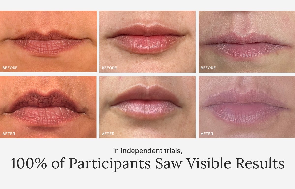 Before and After images of lips after using this product. In the independent trials, 100% of participants saw visible results.