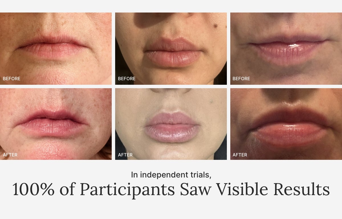 Before and After images of lips after using this product. In the independent trials, 100% of participants saw visible results.