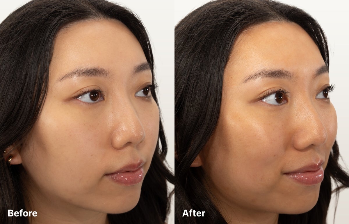A Before and After RealResult of a woman’s face after using Bronze Drops.