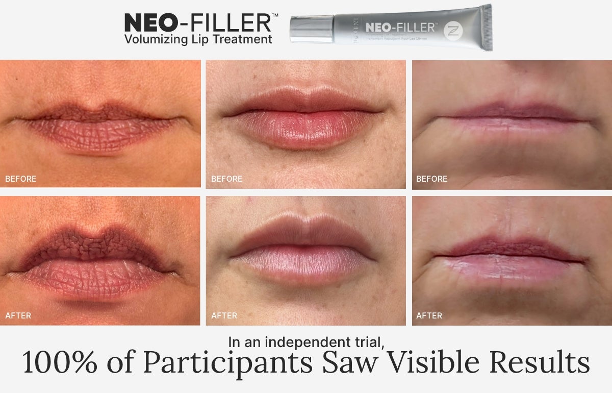 A collage of Before and After real results of the lips of participants that have used the Ultimate Volumizing Lip Care System.