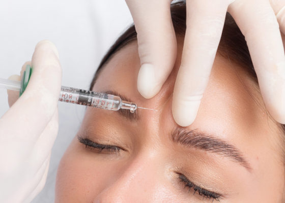 Comparing Natural Fillers vs Traditional Fillers