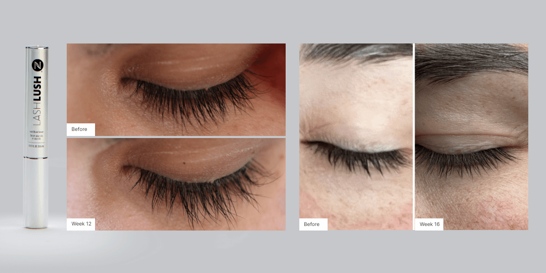 Before and After Real Results of customers that have used LashLush.