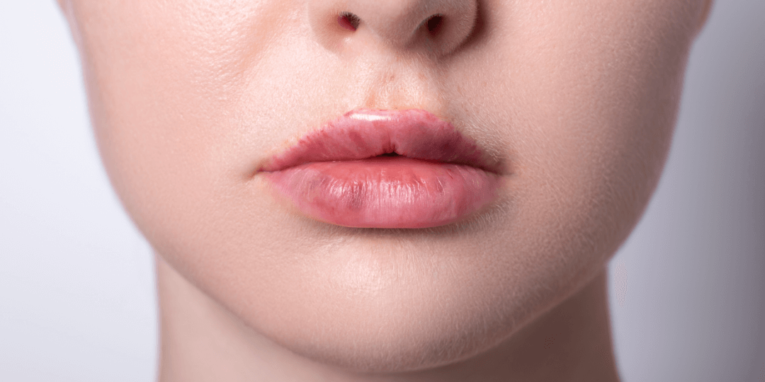 A woman's lips.