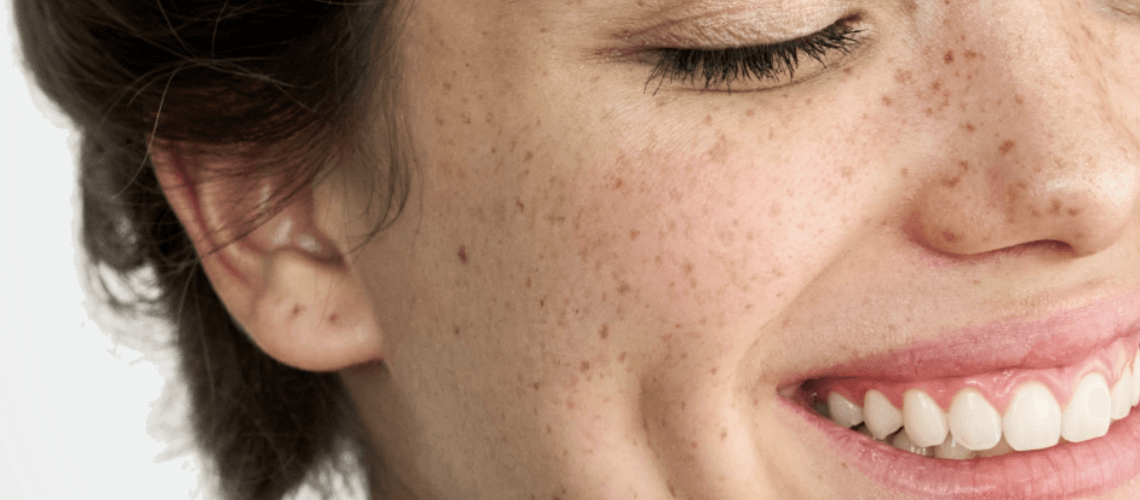 Can You Boost Collagen Production in 30 Days?