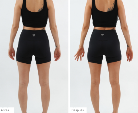 Imágenes de antes y después de personas que han usado Espuma Autobronceadora 3 en 1 para obtener un bronceado natural y sin rayas